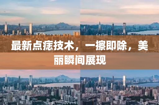 最新点痣技术，一擦即除，美丽瞬间展现